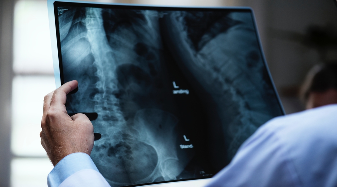 Prophecy: God is Giving Dedicated Seers X-ray Vision